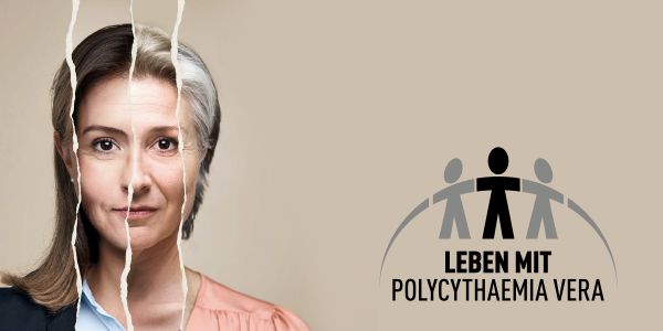 Leben mit Polycythaemia vera Banner